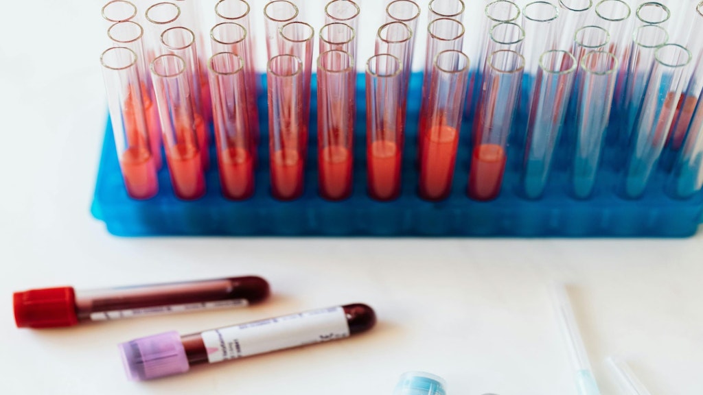 The image shows several test tubes filled with red liquid in a blue holder and two blood sample tubes on a white surface.